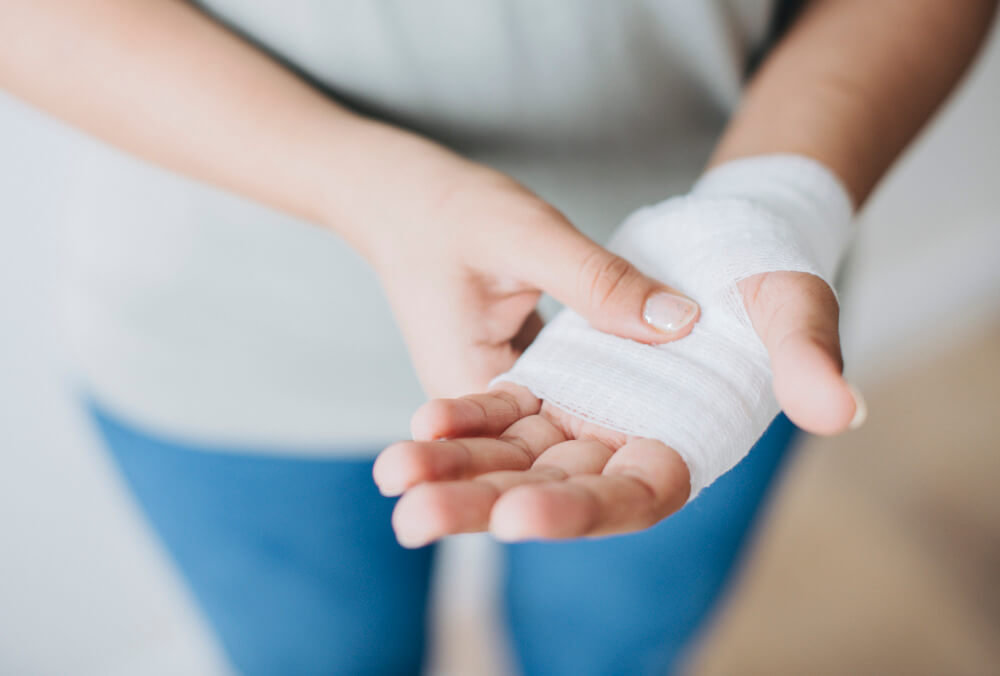 woman with bandage wrapped around her hand